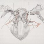 All you need to know about hysterectomy
